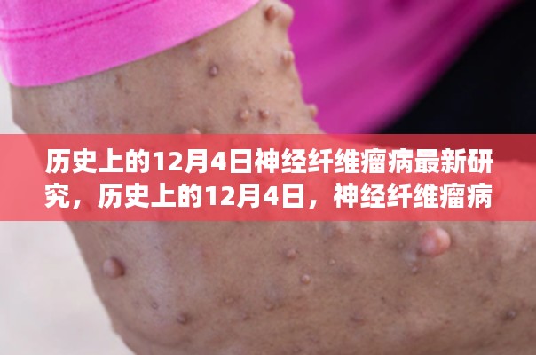 歷史上的神經(jīng)纖維瘤病研究之旅，與自然美景共舞，探尋內(nèi)心寧靜港灣的新突破