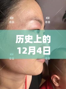 革命性雀斑最新技術(shù)誕生，重塑美顏新紀(jì)元，歷史上的十二月四日里程碑式突破