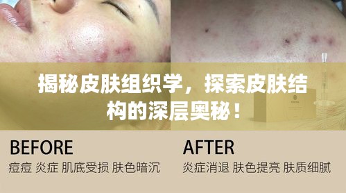 揭秘皮膚組織學(xué)，探索皮膚結(jié)構(gòu)的深層奧秘！