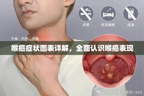 喉癌癥狀圖表詳解，全面認(rèn)識(shí)喉癌表現(xiàn)