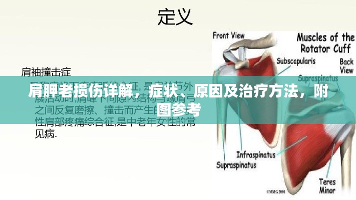 肩胛老損傷詳解，癥狀、原因及治療方法，附圖參考