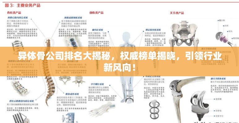 異體骨公司排名大揭秘，權(quán)威榜單揭曉，引領(lǐng)行業(yè)新風(fēng)向！